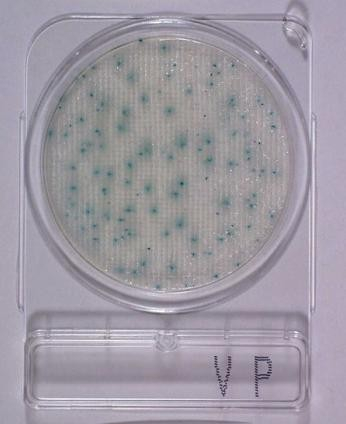Hyserve Compact Dry VP, Vibrio Parahaemolyticus teszt