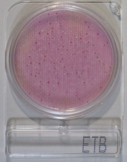 compact_dry_etb_enterobacteriacea_teszt.jpg