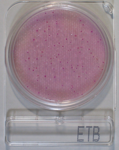 Compact Dry ETB, Enterobacteriacea teszt