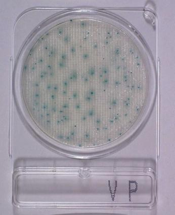 Compact Dry VP, Vibrio Parahaemolyticus teszt